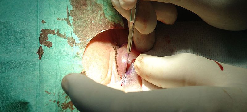 Blefaroplastica | Reginaarco.it